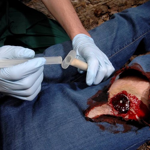 Аппликатор гемостатический с гранулами Rhino Rescue в Анапе хитозановый