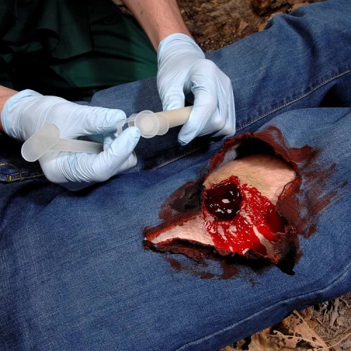 Аппликатор гемостатический с гранулами Rhino Rescue в Анапе хитозановый